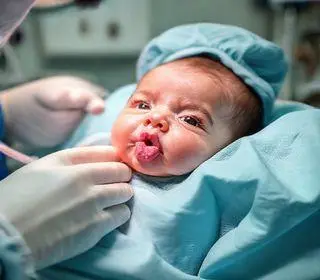 bebê cirurgia língua autorização