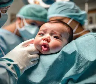 bebê cirurgia língua